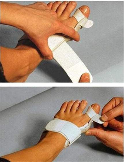 Hallux Valgus Corrector with adjustable foot valgus separator for day and night bunion correction and postoperative support